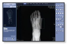 foot